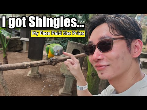 Shingles Hit Me…I Hope It Never Hits You