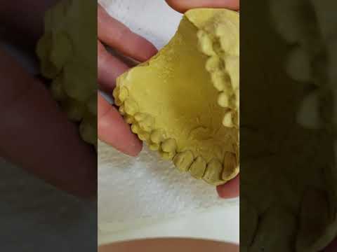 Blocking out a model for a standard essix retainer