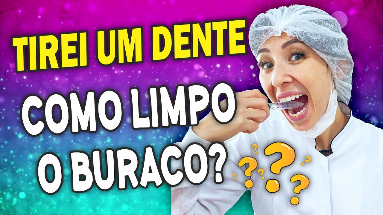 TIREI UM DENTE: COMO LIMPAR O BURACO QUE FICOU DRA. Jaque Akemi - LONDRINA-PR
