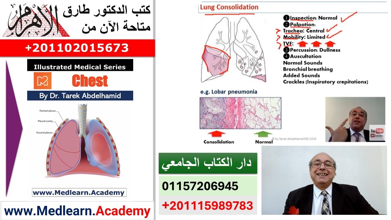 Chest (Introduction) Part II  #cme #internal_medicine #medical #usmle #محاضرات_باطنة