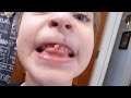 Ivan's NASTY loose tooth! Disgusting! Do not watch!