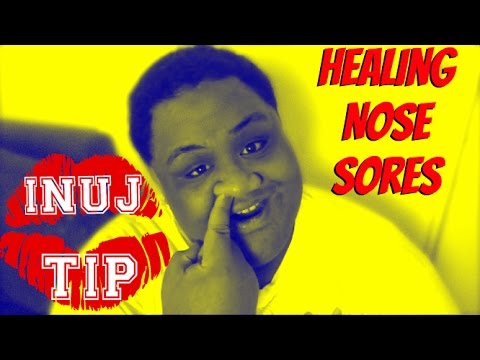 INUJ TIP | HEALING NOSE SORES