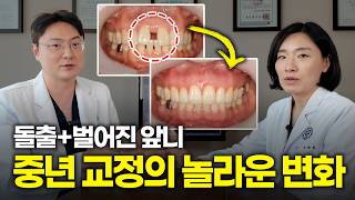 유튜브썸네일