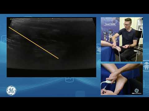 Venue Family | Ankle joint assessment and injection