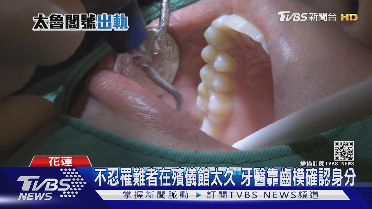 太魯閣罹難者容貌難辨識 牙醫靠齒模成功比對身分