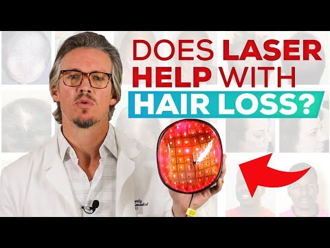 Laser Treatment For Hair Loss And Hair Regrowth: Does It Work? (Q&A)