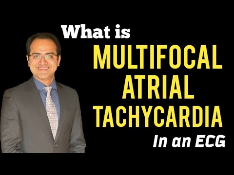 Wandering atrial pacemaker, Multifocal Atrial Tachycardia (MAT) ECG Lectures, Treatment, USMLE