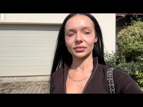 VLOG - CO JA ZROBIŁAM Z TWARZĄ 😳