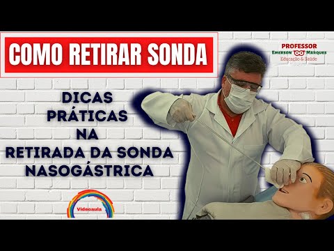 HOW TO REMOVE A NASOGASTRIC TUBE
