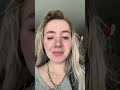 MY EYES FALLING OUT | KAYLAMALECC | #shorts