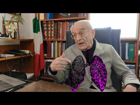Severino Bruna-3