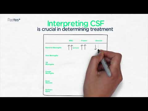 Topic Summary of MENINGITIS by Dr Mas Chaponda