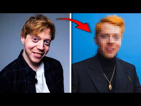 Lägger 50.000 på mitt utseende – hur snygg kan jag bli?