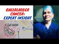 Gallbladder Cancer Symptoms, Diagnosis, Treatment. Expert Insight with simple line drawings.