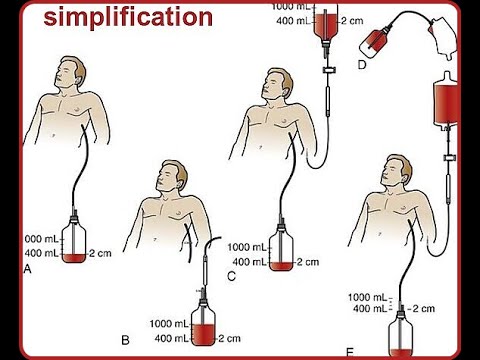 What is Microscope different types of microscope work advantage and working principle