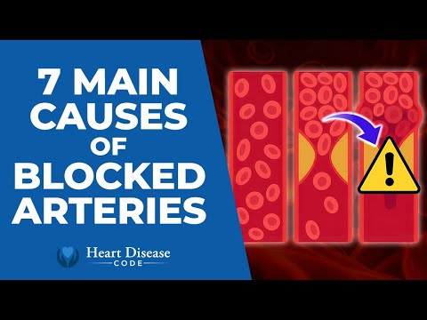 7 Main Causes of Blocked Arteries
