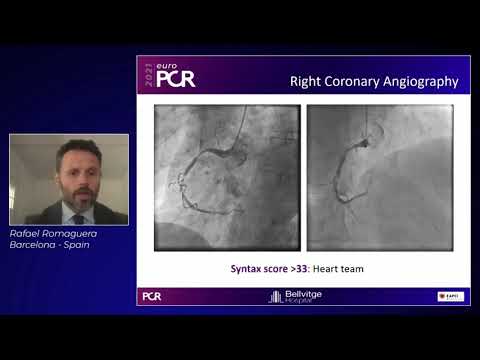 Empowering DES performance in complex patients to maximise efficacy and safety outcomes - #EuroPCR