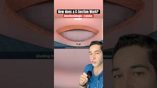 Download lagu Bagaimana Operasi Caesar BENAR-BENAR bekerja? mp3