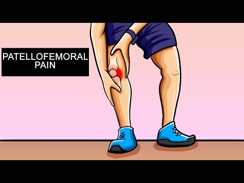 CHONDROMALACJA, TRZESZCZENIE W KOLANIE,  BÓL RZEPKOWO-UDOWY.  TRENUJ BEZ BÓLU KOLAN.