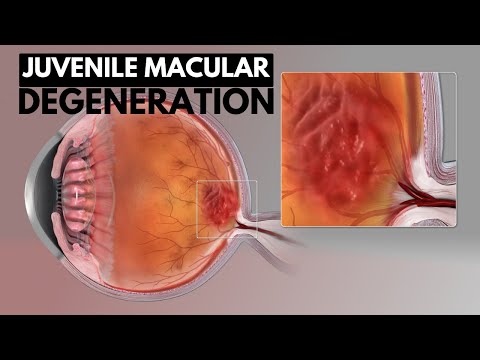 Effects of Cannabis on your body