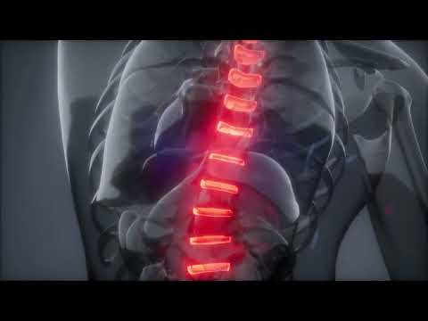 The Spinal Tapper by Sapien Medicine