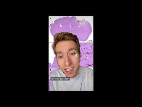 MUSIQ Science Slam: Jan Majer (ESR13)