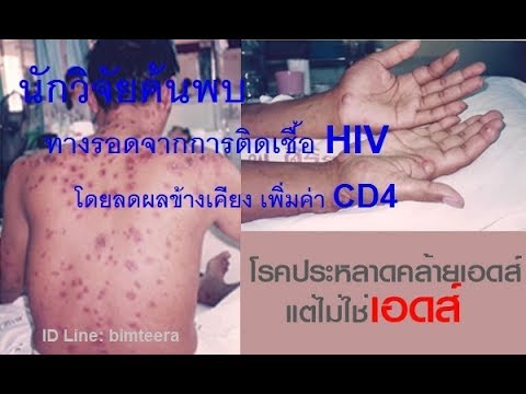 ครีมสมาชิก uvilichit จากความอ่อนแอฮอร์โมนเพศชาย