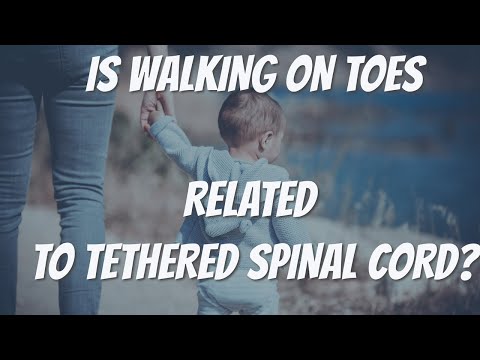 IS WALKING ON TOES RELATED TO TETHERED SPINAL CORD?