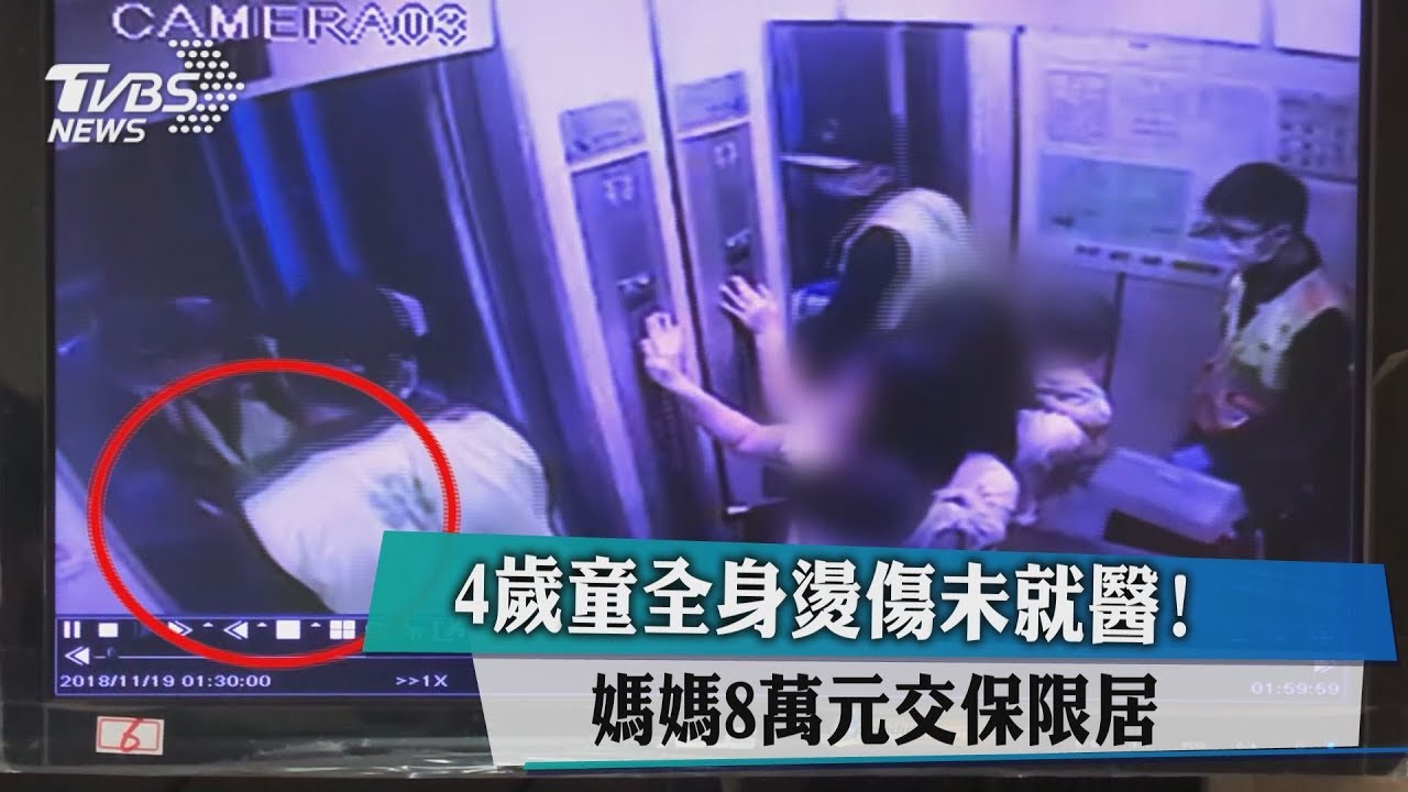 4歲童全身燙傷未就醫! 媽媽8萬元交保限居