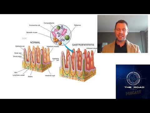 35 When the Stomach Flu Strikes