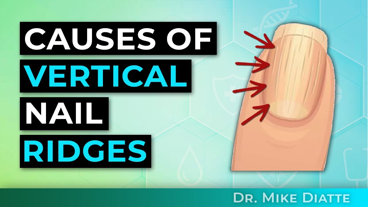 The Cause Of Vertical Ridges on Your Nails