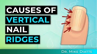 The Cause Of Vertical Ridges on Your Nails