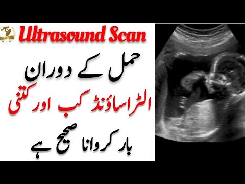 How Many Times Ultrasound Is Safe During Pregnancy l Ultrasound Scan During Pregnancy l Mother Diary Video