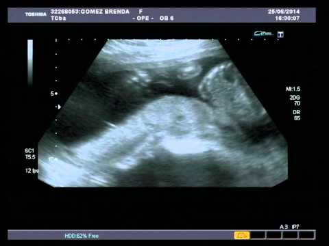 Juan Pablo "Arveja" Busto