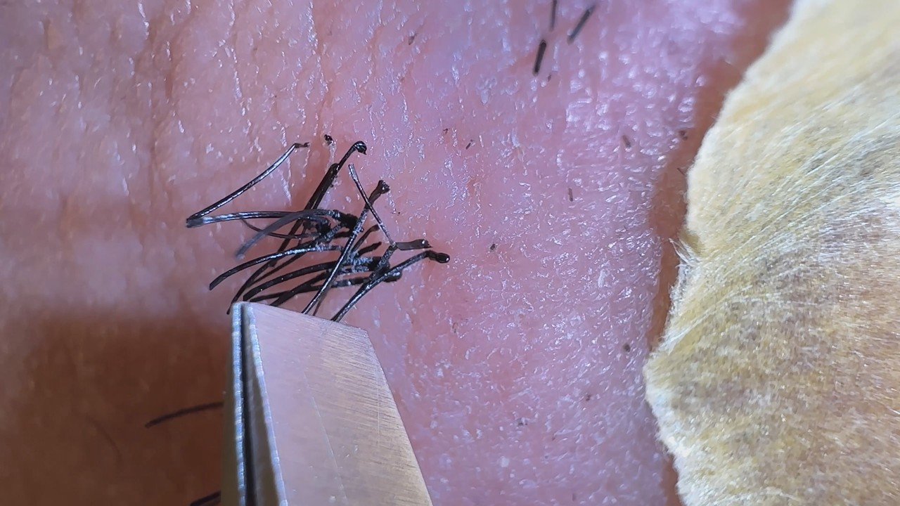 Plucking facial hair 1430 口髭抜き