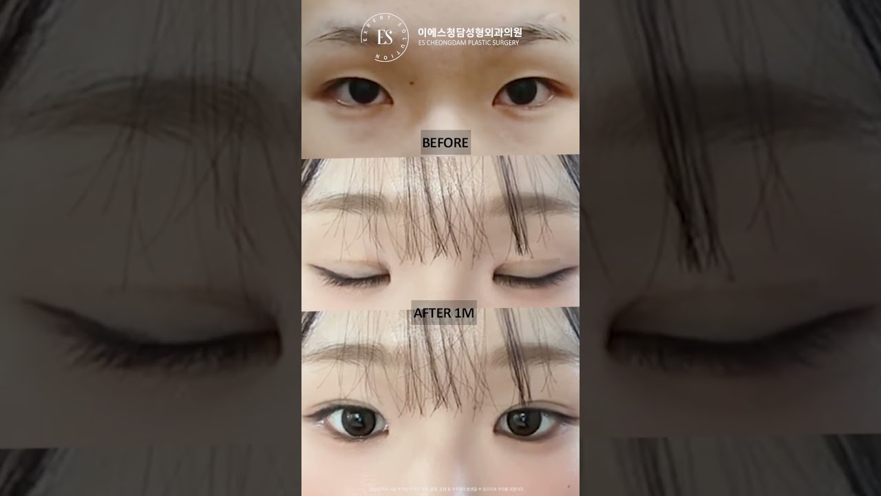 이에스 유튜브