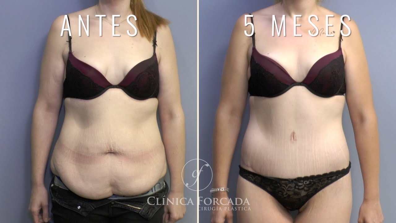 Eduardo Forcada Melero-36