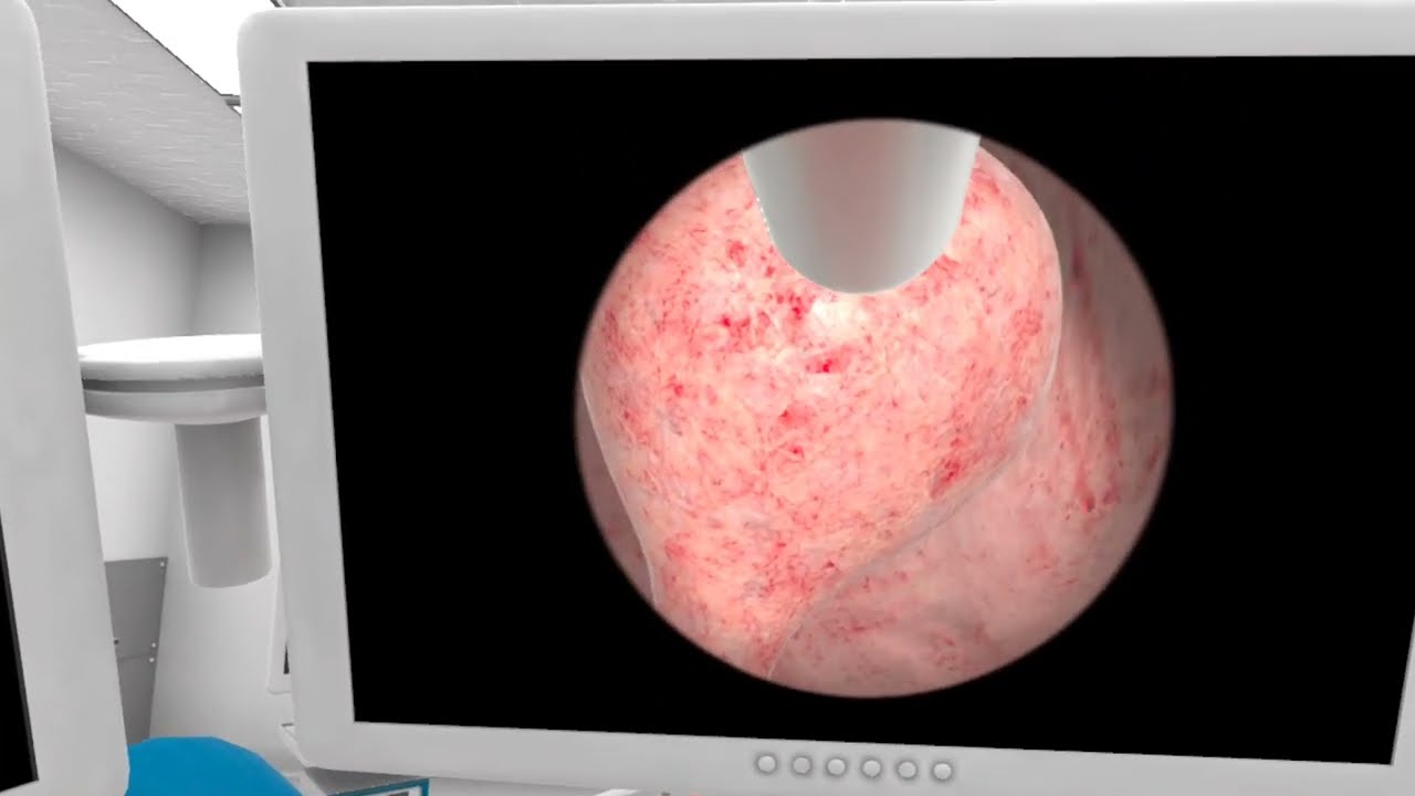 VR Training for Hysteroscopy Simulation | Lucid Reality Labs