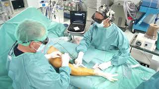 Servicio de Angiología y Cirugía Vascular Hospital La Luz