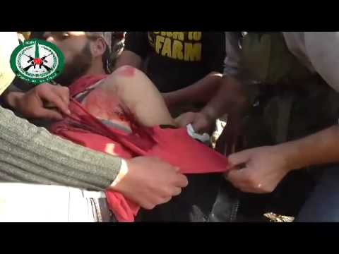 أحد جرحى فرقة عمود حوران ضمن معركة نصر من الله وفتح قريب في ريف القنيطرة