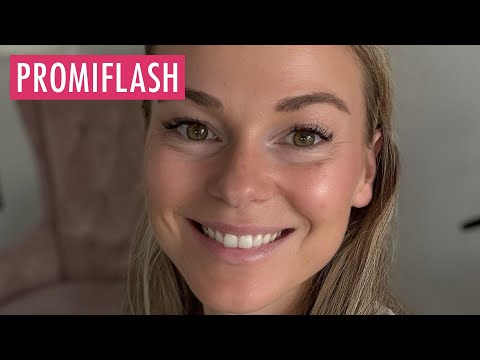 So geht Mareike Schneider mit Kritik zu ihrem Körper um