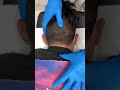 LOUD NECK AND UPPER BACK CRACKS FROM A CHIROPRACTIC ADJUSTMENT BY THE KING OF CRACKS
