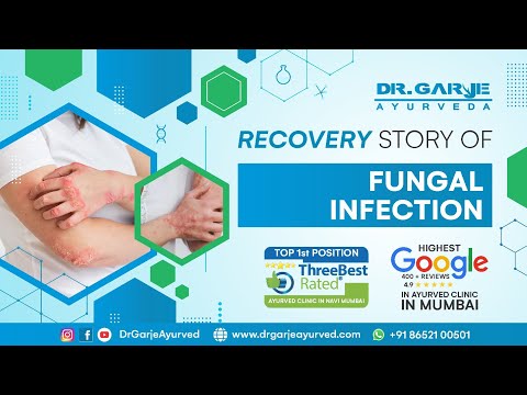  Panchakarma Patient Testimonial - Review 17