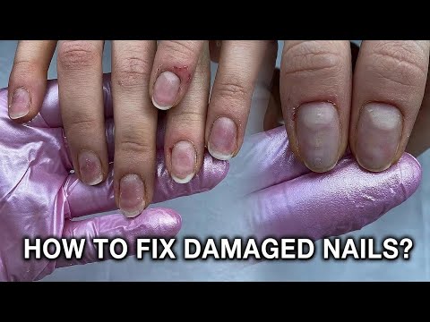 How to Fix Thin, Over-Filed Nails—Step-by-Step Recovery Guide