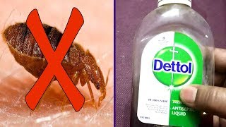 Natural trick to get rid of bed bugs fast and permanently in your mattress