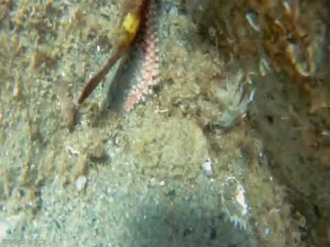 Contatti helminth da una classe tsestod Quello che lanalisi del sangue è fatta su conto di vermi