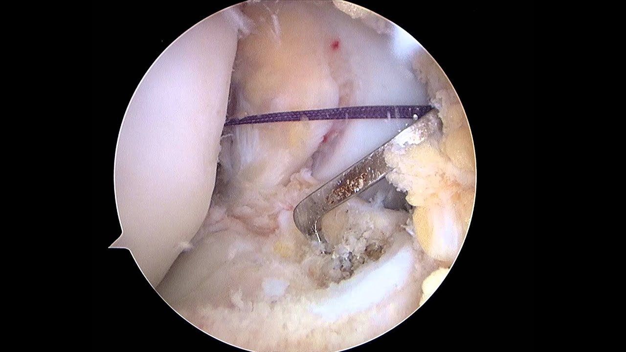 José Ignacio Eugenio Díaz-8