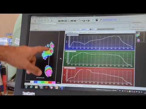 Die Fußanalyse bei Kriwat in Kiel