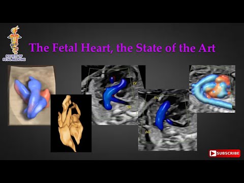 The Fetal Heart The State of The Art