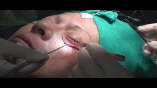 Dr. Philip Young